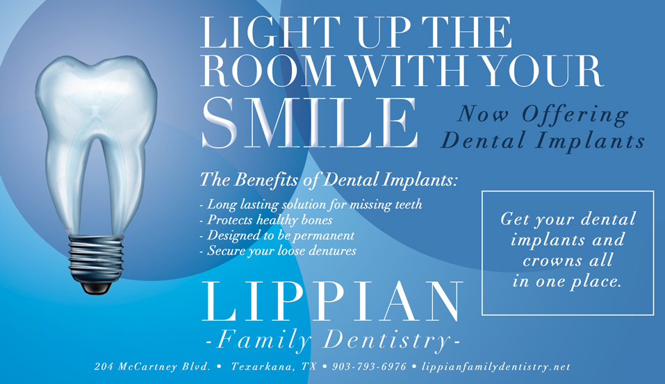 Now offering dental implants