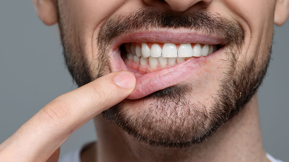 Man showing healthy gums | Family Dentistry in Texarkana, TX